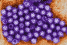 electron microscope image of norovirus